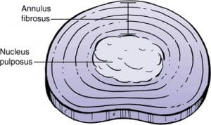 What a disc is made of