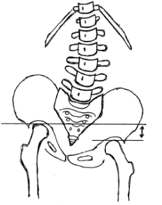 Spine Alignment and Posture
