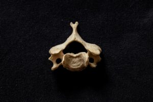 A spinal vertebra.
